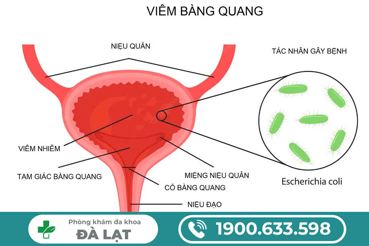 Hình ảnh minh họa